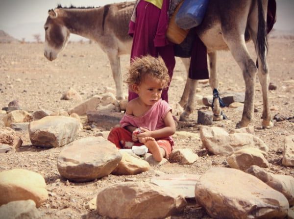 pauvreté maroc - Malnutrition : 1,2 marocains concernés (ONU)