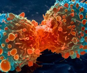cancer 300x250 - Santé: Des médicaments anti-cancéreux seront produits au Maroc