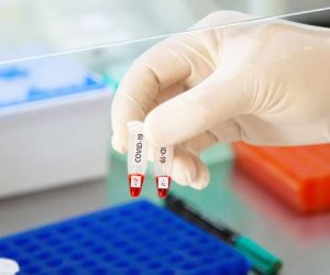 analyse covid 300x250 - Covid-19 : Tous les laboratoires peuvent réaliser les tests, mais…