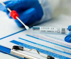 test PCR 300x250 - Covid-19: Les prix des tests PCR bientôt fixés à 400 dhs
