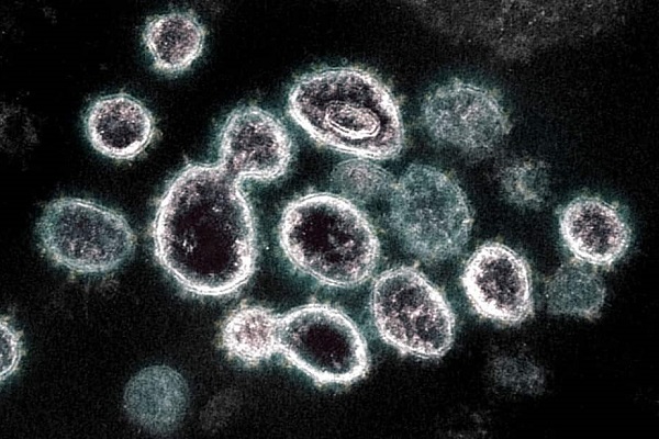 2982982 - Covid-19: le sous variant BA.2 nécessite plus de vigilance que d’inquiétude (expert)