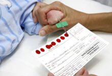 depistage neonatal 220x150 - Maladies rares : l’AMRM plaide pour un dépistage néonatal élargi